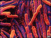 Fecal transplantation for refractory C. DIFFICILE infections | The ...