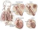 Chronic Obstructive Pulmonary Disorder (COPD) Case Study | Nursing ... 