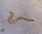 adult male of <b>Enterobius</b>