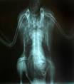 unusual xray images