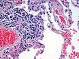 Tissue (biology) - Wikipedia, the free encyclopedia