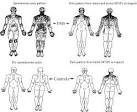Science Direct.com - PAIN - Contribution of the local and referred ... 