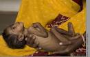 Arogya_Shoodh: Malnutrition: Reality behind Govt Health care ...