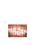 http://armymedical.tpub.com/MD0511/MD05110057im.jpg