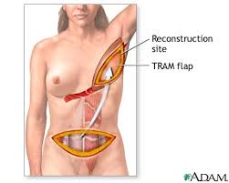 http://t2.gstatic.com/images?q=tbn:ANd9GcQadwcEkINpKV3OTYTMEnl8bAfvDRFNXRSkSy019f2ab4XtbLTu