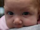 Infant Botulism