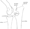 ELBOW DYSPLASIA