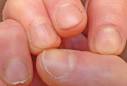 Part 3: Nails | When This Is, That Is