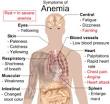 <b>Anemia</b> - Wikipedia, the free