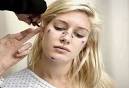 celebrity plastic surgery 2011