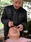 Eyeball Shaving: Liu Deyuan Uses Knife To Clean Eyes In China