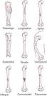 <b>fracture</b> [frak´chur]
