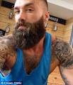 Calum Best ditches beard ss he prepares for THIRD hair transplant.