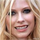 Avril Lavigne has bad teeth.
