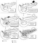 Chronic <b>pancreatitis</b>