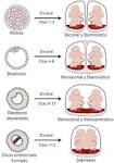 Cómo saber si son <b>gemelos</b> o mellizos? Tipos de embarazo múltiple