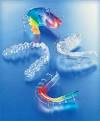 La <b>férula oclusal</b>