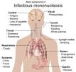 <b>Infectious mononucleosis</b>