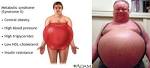 HIIT Training: The Cure for Insulin Resistance, Type 2 Diabetes ...