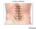<b>Lumbar vertebrae</b>