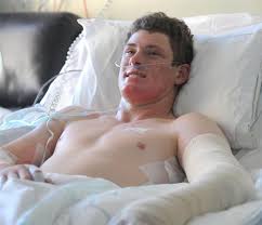 Telford Rural Polytechnic student Matthew Scally (18) recovers in Dunedin Hospital after landing on a burning couch in Hyde St on Friday night. - telford_rural_polytechnic_student_matthew_scally_1_7265017054