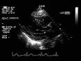 Common Abnormalities of the Heart — The Nicholas Institute of ...