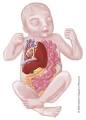 Fetal Concerns Center of Wisconsin: Congenital Diaphragmatic Hernia