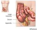 HowStuffWorks "How Your Appendix Works"