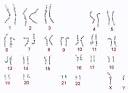 CDO - Intro To Chromosomes