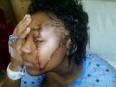 Carina Bernard allegedly attacked Lewis on Franklin Avenue, ... - images?q=tbn:ANd9GcQo-5ZrwNHuLvVziIZ9gJCJfEOInAo5dlbBs-ChveJCXnTRinhBTKCiyaU