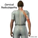 to Cervical <b>Radiculopathy</b>