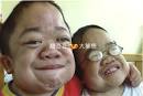 Johnny Yeung (left), 14, MPS VI and his younger sister Annie Yeung, ... - 10-3