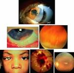 Pupil (band)