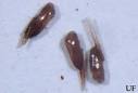 Head Lice Remedies and Hair Lice Home Treatment