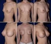 http://t2.gstatic.com/images?q=tbn:ANd9GcQtaOUFe_-r0o2rKi9GABqI8Xw8i4BI4twPyg1RagtO_wg3CF8j_hbgBw2Z