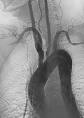 of <b>Takayasu's arteritis</b>