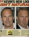 Top 10 celebrity hair transplants | Before and After | Hair ...