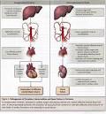 <b>Hepatorenal Syndrome</b>