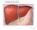In the liver, alcohol converts