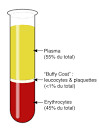 Bestand:BloodPlasma.jpg - Wikipedia