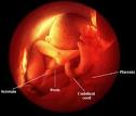 WPClinic.org : Choices You Can Live With » Third Trimester