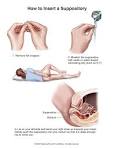 Summit Medical Group - Docusate, Rectal
