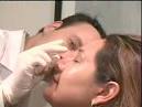 Procedure by Dr. Rivkin