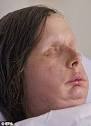 Charla Nash: Chimp maul victim suing state for $150MILLION in ...