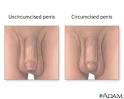  Male reproductive hygiene: Medline Plus Medical Encyclopedia Image