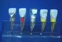and <b>dental pulp disease</b> A