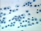 <b>Histiocyte</b>