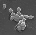 <b>Enterococcus faecalis</b>.