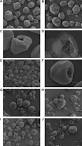Evidence of native starch degradation with human small intestinal ...