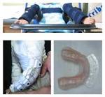 of <b>Lesch</b>-<b>Nyhan syndrome</b> is www.ojrd.com
